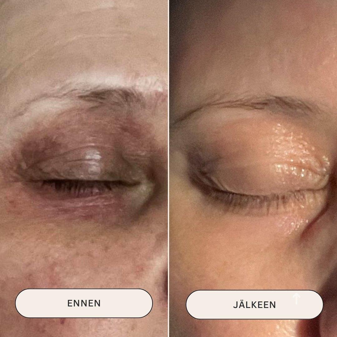 BOTANICAL EYE REPAIR Ravitseva öljyseerumi silmänympärysiholle & ripsille