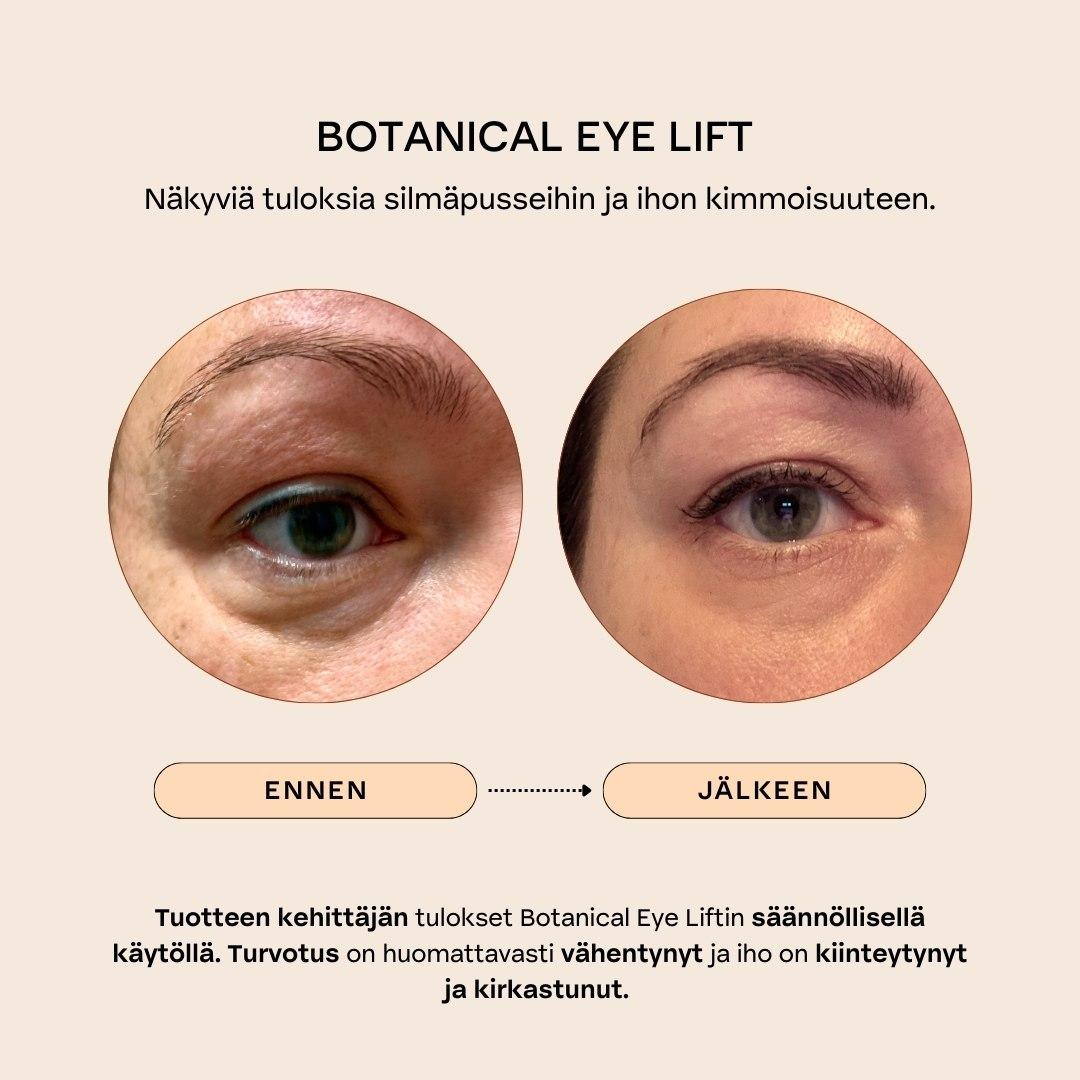 BOTANICAL EYE LIFT Kiinteyttävä & turvotusta vähentävä silmänympärysseerumi