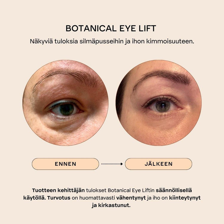 BOTANICAL EYE LIFT Kiinteyttävä & turvotusta vähentävä silmänympärysseerumi