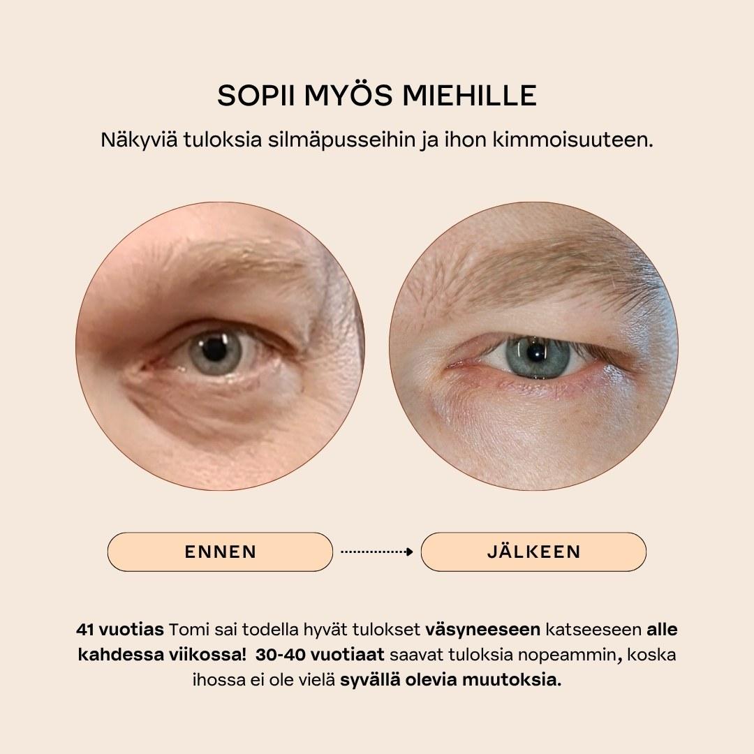 BOTANICAL EYE LIFT Kiinteyttävä & turvotusta vähentävä silmänympärysseerumi
