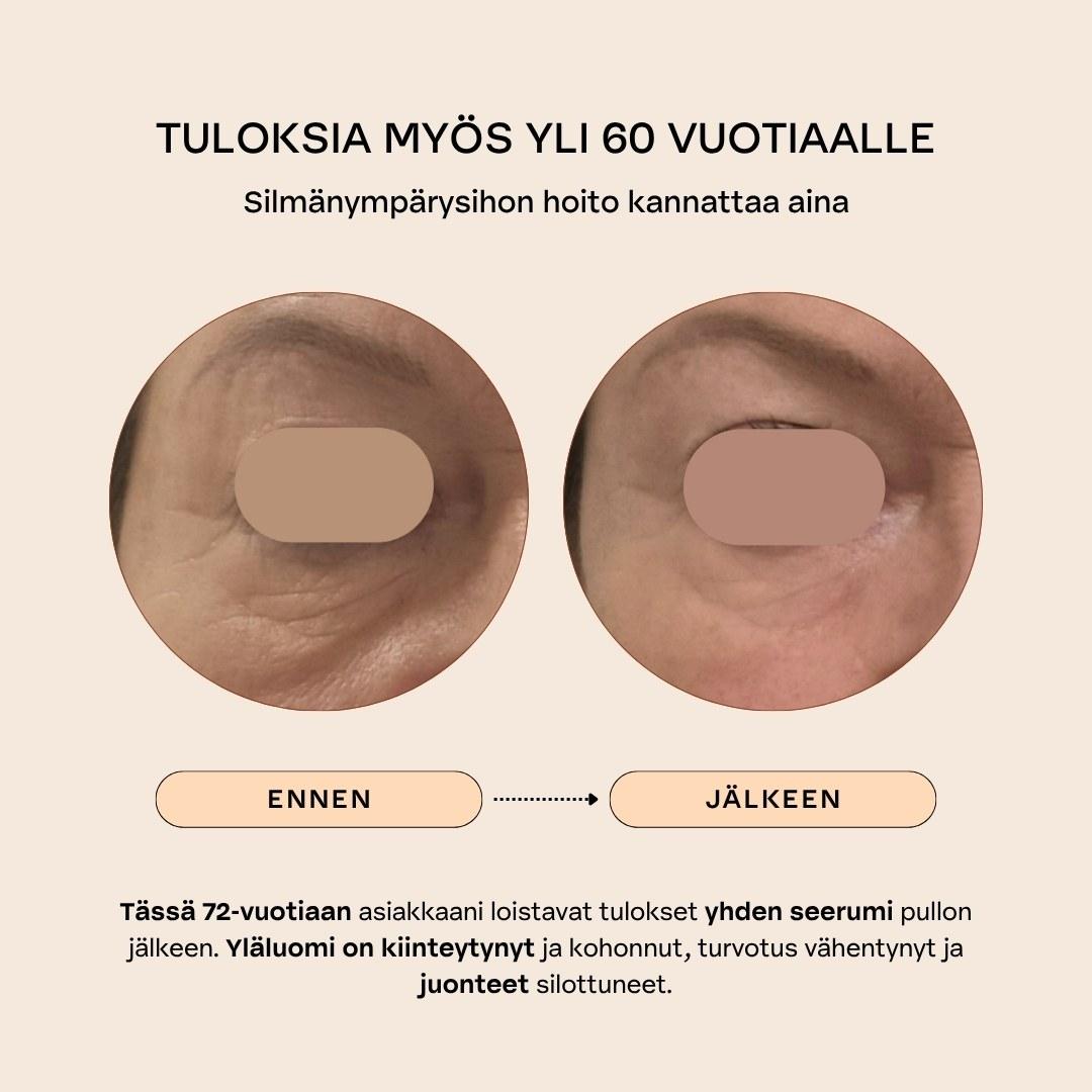 BOTANICAL EYE LIFT Kiinteyttävä & turvotusta vähentävä silmänympärysseerumi