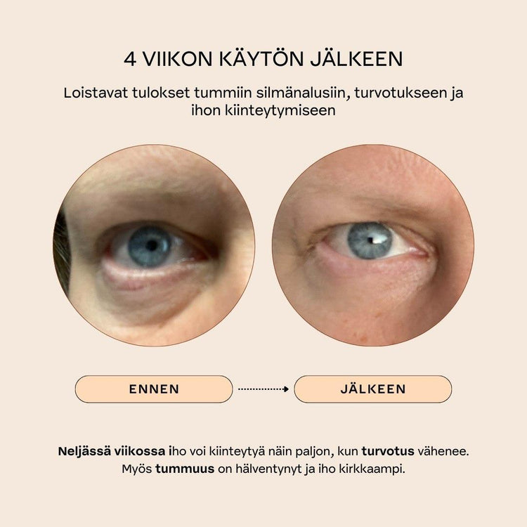 Botanical Eye Lift kiinteyttävä silmänympärysvoide