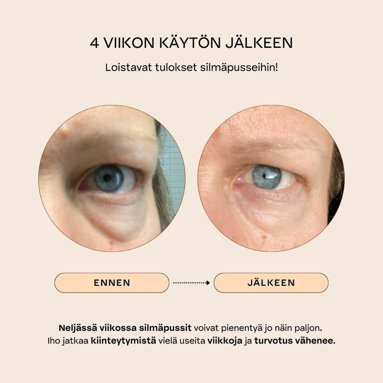 Botanical Eye Lift silmäpussit pois