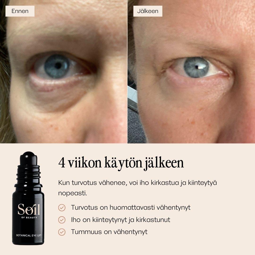Botanical Eye Lift silmänympärysseerumi. Ennen ja jälkeen kuvat. 
