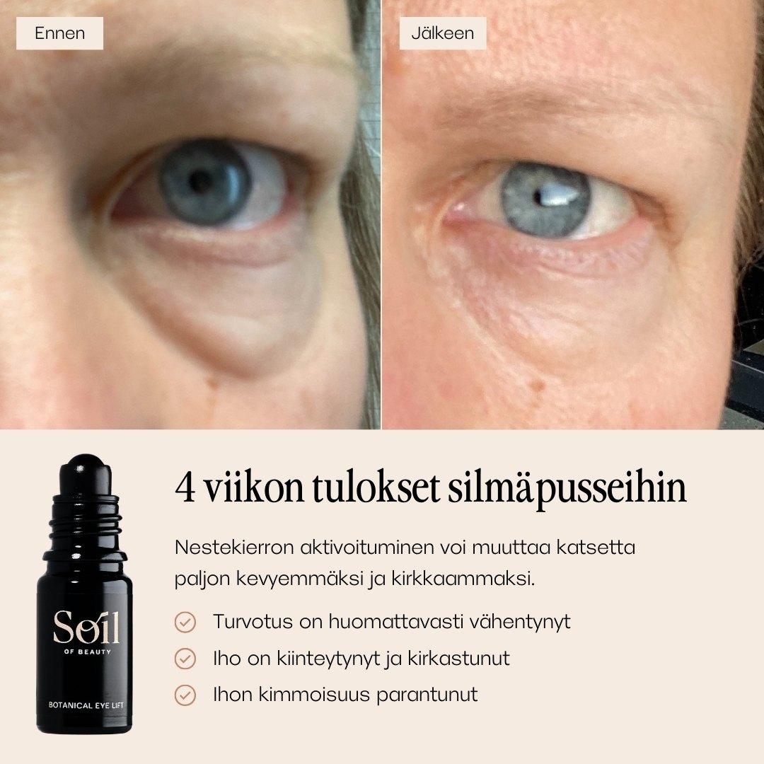 Botanical Eye Lift silmänympärysseerumi. Ennen ja jälkeen kuvat. 